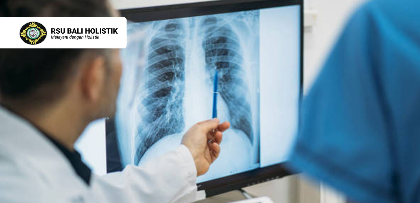 Cara-Mendiagnosis-Paru-Paru-Basah-Serta-Pengobatannya